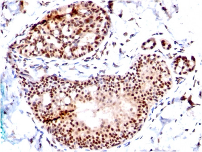 SUMO-1 Antibody in Immunohistochemistry (Paraffin) (IHC (P))