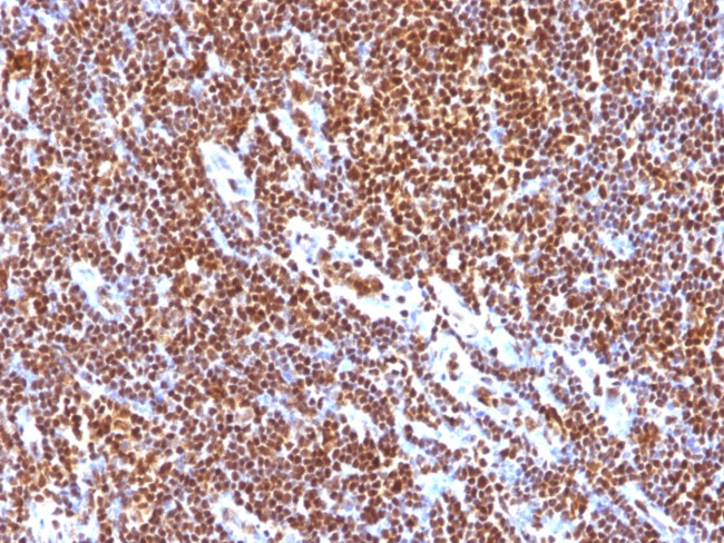 SUMO-1 Antibody in Immunohistochemistry (Paraffin) (IHC (P))