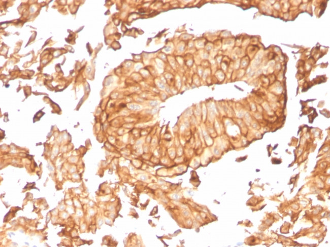 Uroplakin 1B Antibody in Immunohistochemistry (Paraffin) (IHC (P))