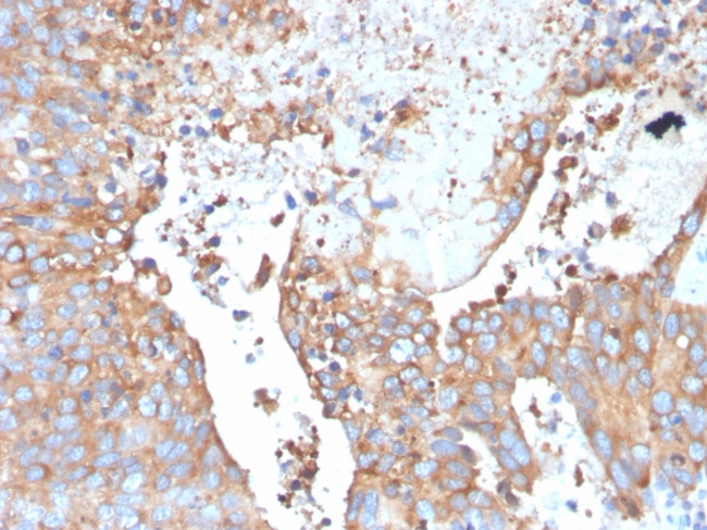 Uroplakin 1B Antibody in Immunohistochemistry (Paraffin) (IHC (P))