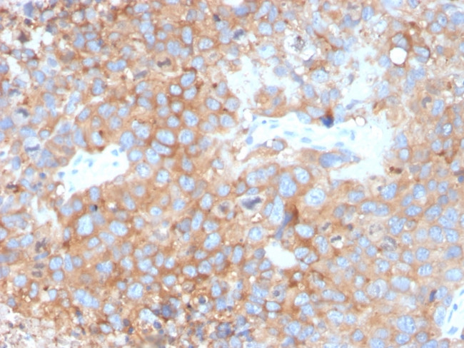 Uroplakin 1B Antibody in Immunohistochemistry (Paraffin) (IHC (P))