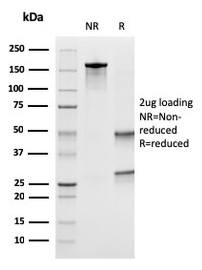 Uroplakin 1B Antibody in SDS-PAGE (SDS-PAGE)