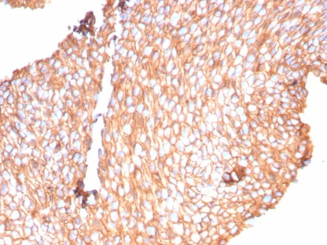 Uroplakin 1B (Urothelial Differentiation Marker) Antibody in Immunohistochemistry (Paraffin) (IHC (P))