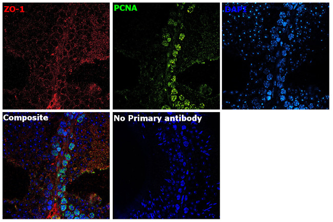 ZO-1 Antibody in Immunohistochemistry (Paraffin) (IHC (P))