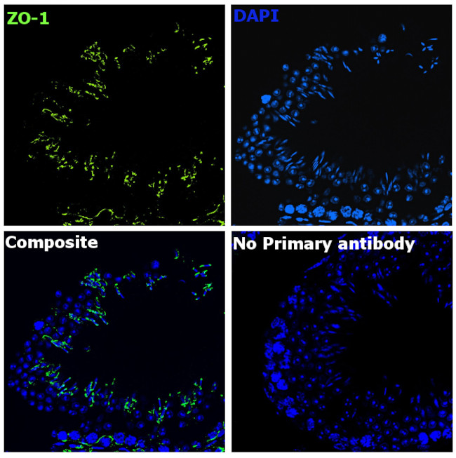 ZO-1 Antibody in Immunohistochemistry (Paraffin) (IHC (P))