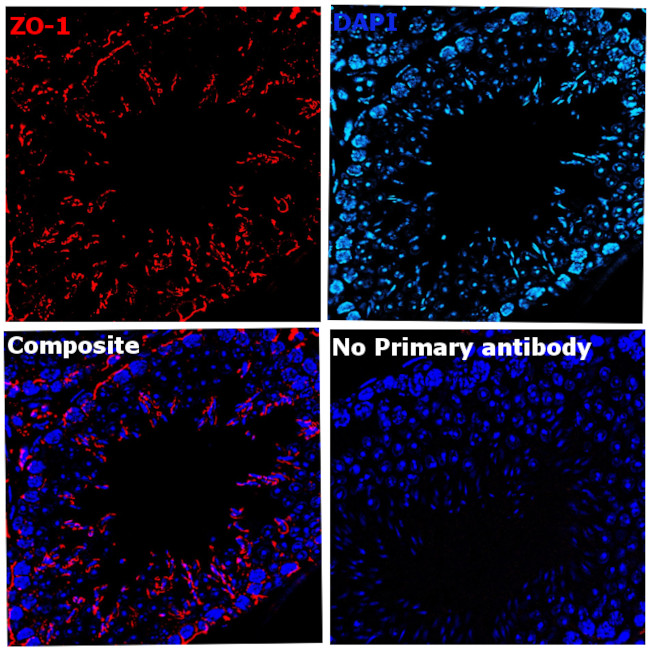 ZO-1 Antibody in Immunohistochemistry (Paraffin) (IHC (P))