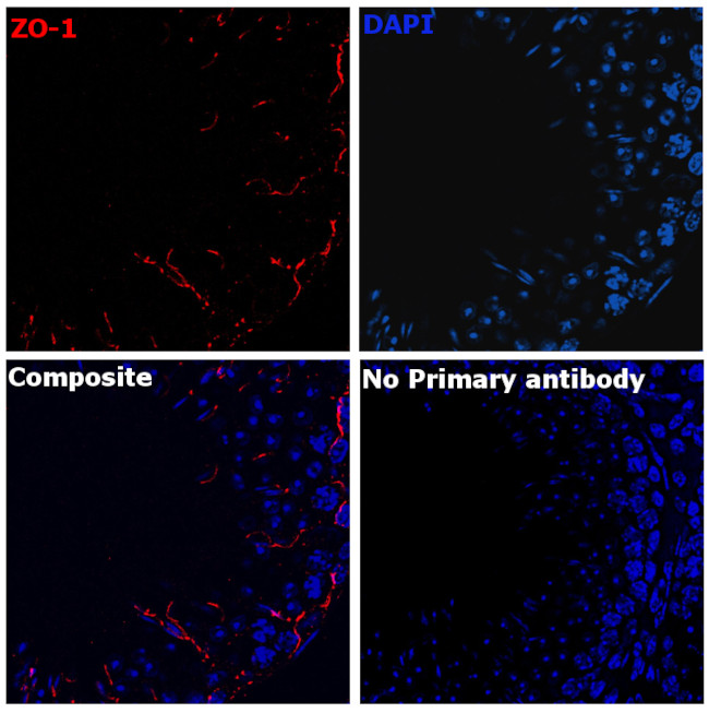 ZO-1 Antibody in Immunohistochemistry (Paraffin) (IHC (P))