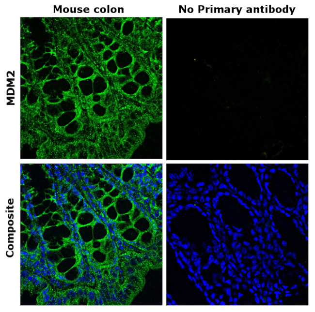 MDM2 Antibody in Immunohistochemistry (Paraffin) (IHC (P))