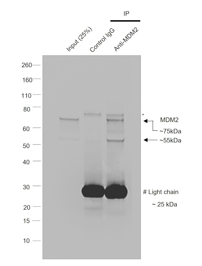 MDM2 Antibody in Immunoprecipitation (IP)