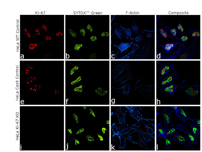 Ki-67 Antibody in Immunocytochemistry (ICC/IF)