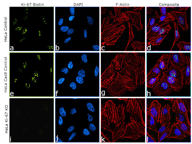 Ki-67 Antibody in Immunocytochemistry (ICC/IF)