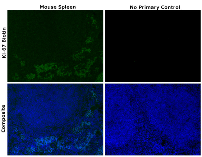 Ki-67 Antibody in Immunohistochemistry (Paraffin) (IHC (P))