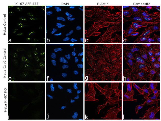 Ki-67 Antibody in Immunocytochemistry (ICC/IF)