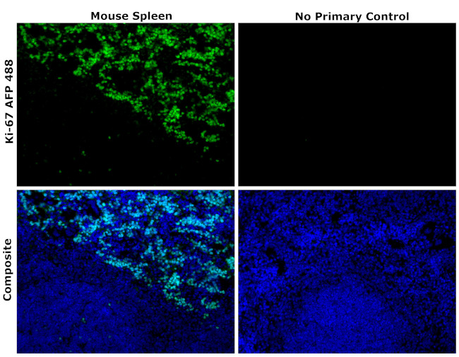 Ki-67 Antibody in Immunohistochemistry (Paraffin) (IHC (P))