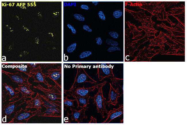 Ki-67 Antibody in Immunocytochemistry (ICC/IF)