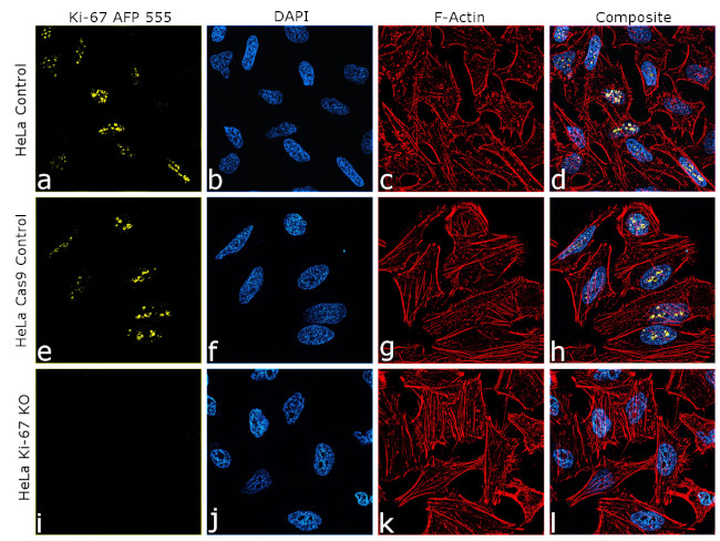 Ki-67 Antibody in Immunocytochemistry (ICC/IF)