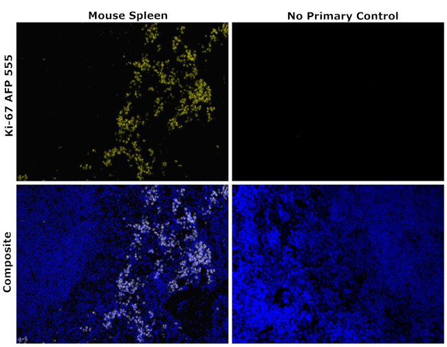 Ki-67 Antibody in Immunohistochemistry (Paraffin) (IHC (P))