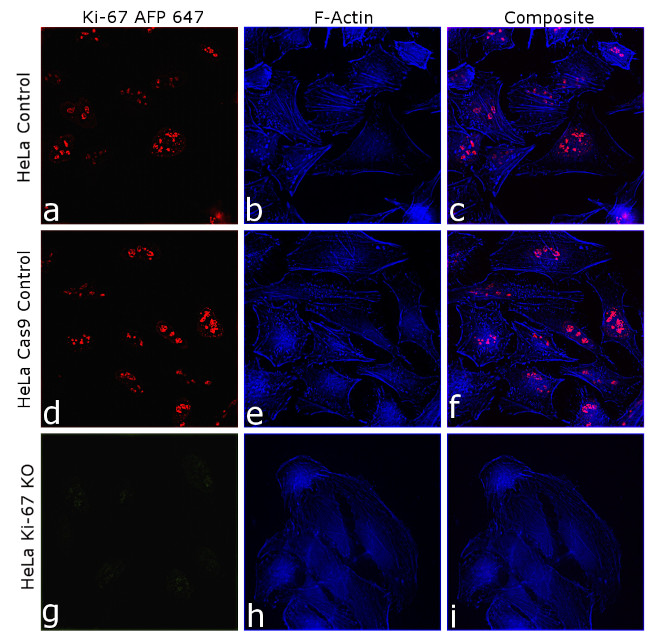 Ki-67 Antibody