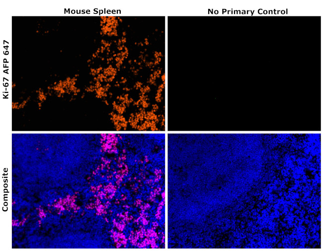 Ki-67 Antibody in Immunohistochemistry (Paraffin) (IHC (P))