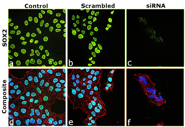 SOX2 Antibody in Immunocytochemistry (ICC/IF)