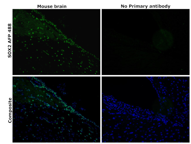 SOX2 Antibody in Immunohistochemistry (Paraffin) (IHC (P))