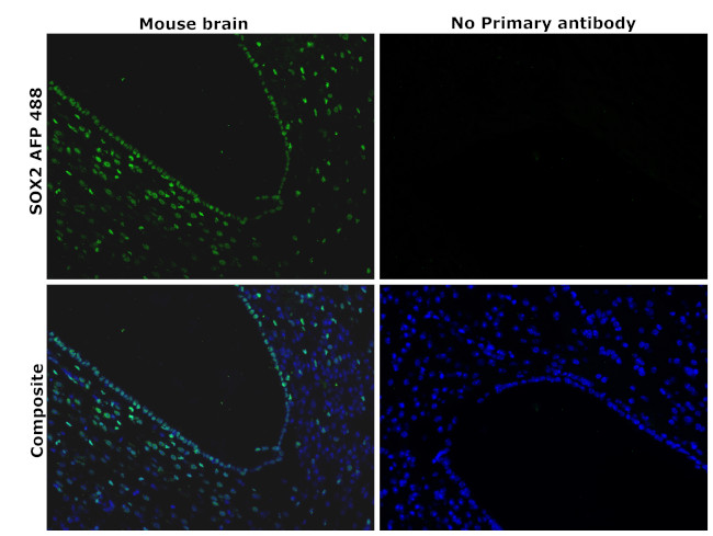 SOX2 Antibody in Immunohistochemistry (Paraffin) (IHC (P))