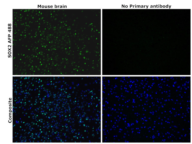 SOX2 Antibody in Immunohistochemistry (Paraffin) (IHC (P))