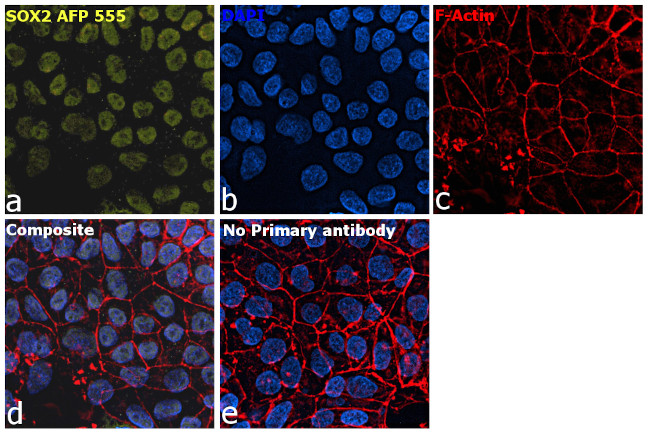 SOX2 Antibody in Immunocytochemistry (ICC/IF)