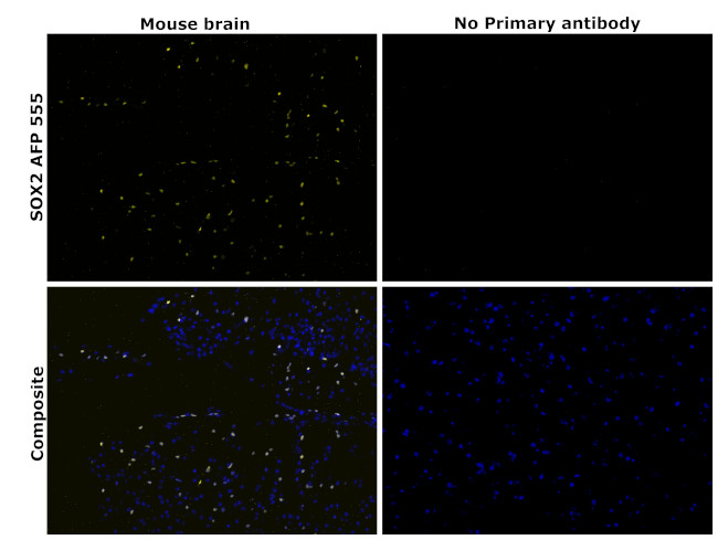 SOX2 Antibody in Immunohistochemistry (Paraffin) (IHC (P))