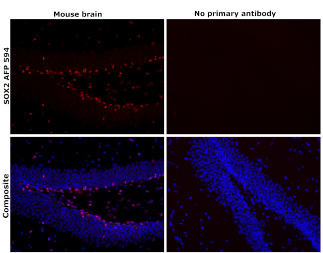 SOX2 Antibody in Immunohistochemistry (Paraffin) (IHC (P))