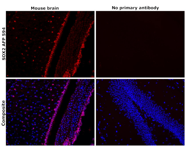 SOX2 Antibody in Immunohistochemistry (Paraffin) (IHC (P))