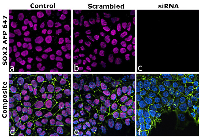 SOX2 Antibody in Immunocytochemistry (ICC/IF)