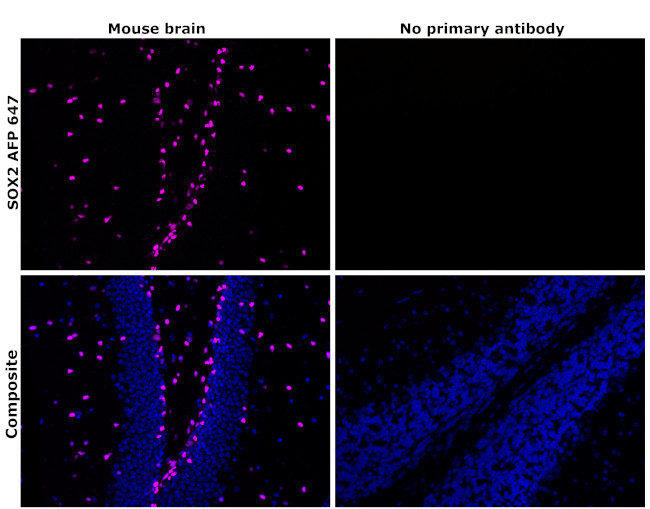 SOX2 Antibody in Immunohistochemistry (Paraffin) (IHC (P))