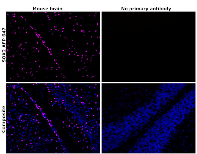 SOX2 Antibody in Immunohistochemistry (Paraffin) (IHC (P))