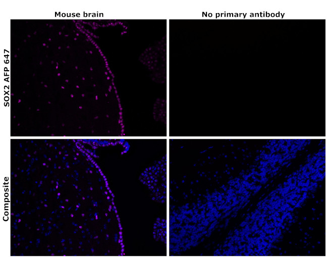 SOX2 Antibody in Immunohistochemistry (Paraffin) (IHC (P))