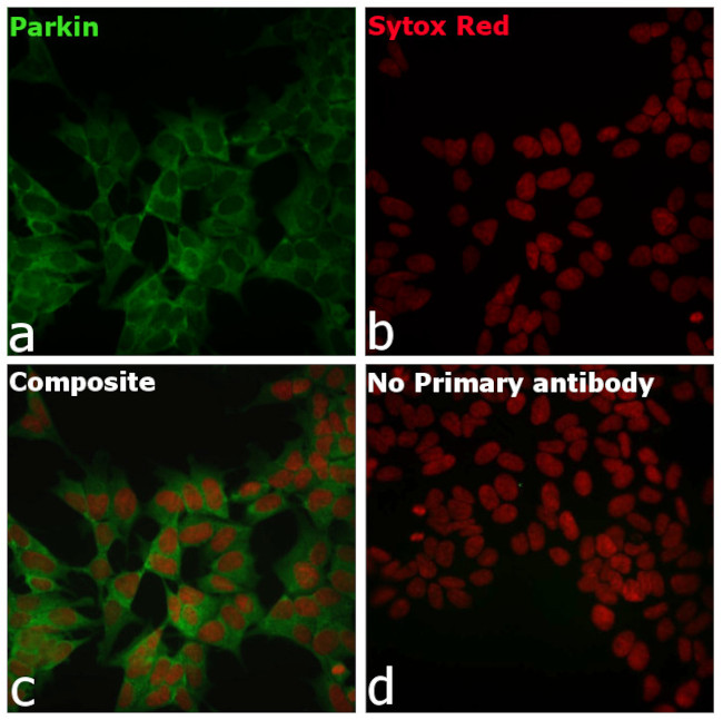 Parkin Antibody in Immunocytochemistry (ICC/IF)