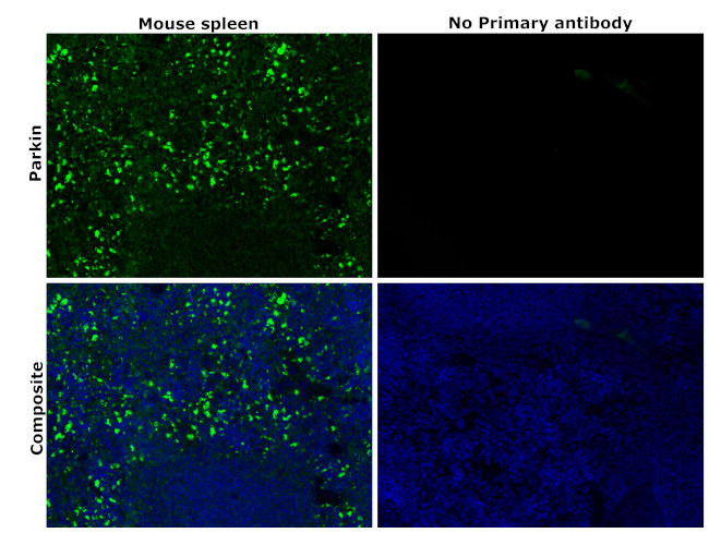 Parkin Antibody in Immunohistochemistry (Paraffin) (IHC (P))