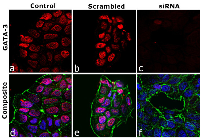 GATA-3 Antibody in Immunocytochemistry (ICC/IF)