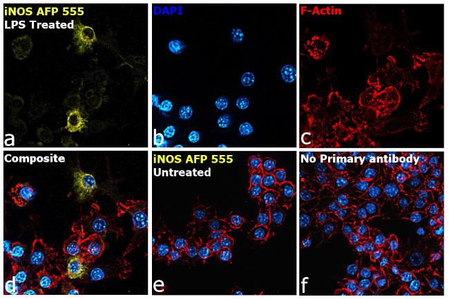 iNOS Antibody in Immunocytochemistry (ICC/IF)