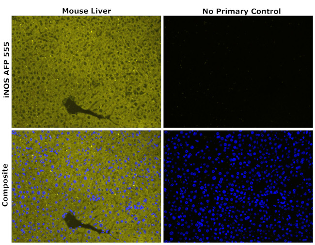 iNOS Antibody in Immunohistochemistry (Paraffin) (IHC (P))