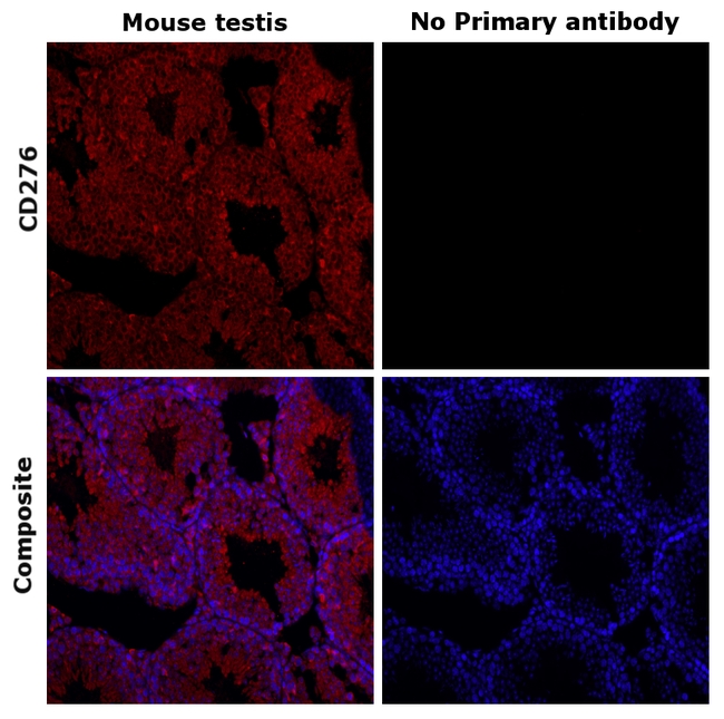 CD276 (B7-H3) Antibody in Immunohistochemistry (Paraffin) (IHC (P))