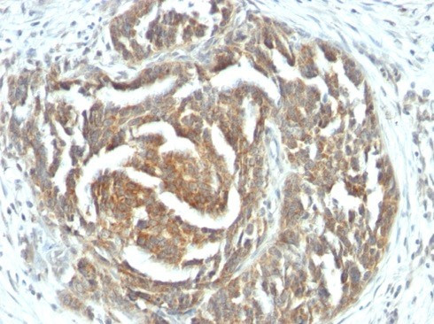 VEGF (Vascular Endothelial Growth Factor) Antibody in Immunohistochemistry (Paraffin) (IHC (P))