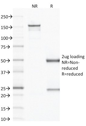 VEGF (Vascular Endothelial Growth Factor) Antibody in SDS-PAGE (SDS-PAGE)