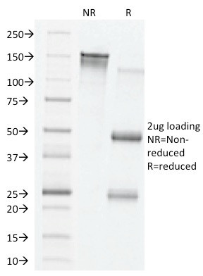 VEGF (Vascular Endothelial Growth Factor) Antibody in SDS-PAGE (SDS-PAGE)