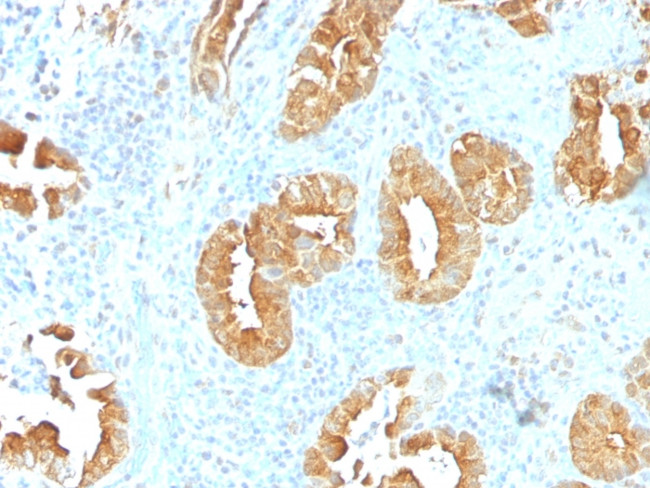 Villin (GI-Mucosal and Urogenital Brush Border Marker) Antibody in Immunohistochemistry (Paraffin) (IHC (P))