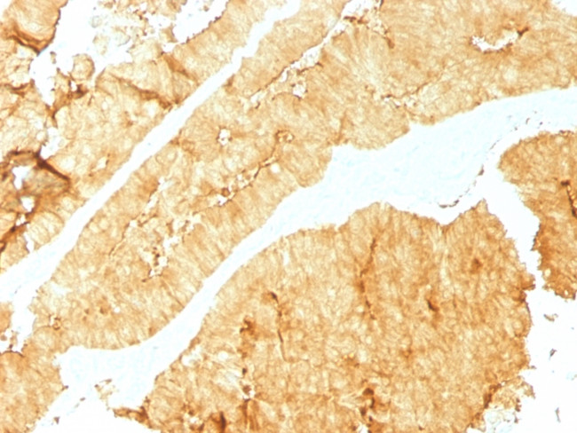 Villin (GI-Mucosal and Urogenital Brush Border Marker) Antibody in Immunohistochemistry (Paraffin) (IHC (P))