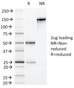 Villin (GI-Mucosal and Urogenital Brush Border Marker) Antibody in SDS-PAGE (SDS-PAGE)