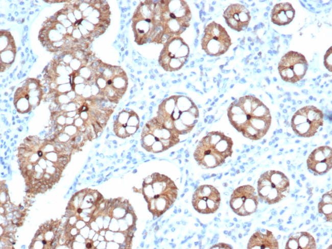 Villin (GI-Mucosal and Urogenital Brush Border Marker) Antibody in Immunohistochemistry (Paraffin) (IHC (P))