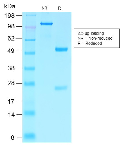 Villin (GI-Mucosal and Urogenital Brush Border Marker) Antibody in SDS-PAGE (SDS-PAGE)