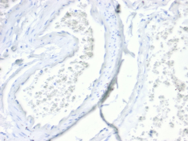 Villin Antibody in Immunohistochemistry (Paraffin) (IHC (P))